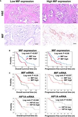 MIF promotes cell invasion by the LRP1-uPAR interaction in <mark class="highlighted">pancreatic cancer cells</mark>